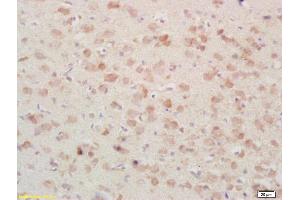 Formalin-fixed and paraffin embedded rat brain tissue labeled Anti-PSAP/PAP Polyclonal Antibody, Unconjugated (ABIN735773) at 1:200, followed by conjugation to the secondary antibody and DAB staining (Prosaposin antibody  (AA 101-200))