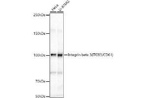 Western blot analysis of extracts of various cell lines, using Integrin beta 3 (ITGB3/CD61) antibody (ABIN6127571, ABIN6142583, ABIN6142585 and ABIN6213608) at 1:1000 dilution. (Integrin beta 3 antibody  (AA 609-788))