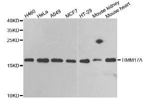 Western blot analysis of extracts of various cell lines, using TIMM17A antibody. (TIMM17A antibody  (AA 1-171))