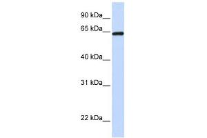 LCP1 antibody used at 1 ug/ml to detect target protein. (LCP1 antibody)