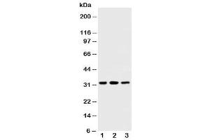 Western blot testing of SDHB antibody and Lane 1:  rat testis (SDHB antibody  (AA 42-59))