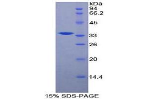 SDS-PAGE analysis of Mouse Raft Linking Protein. (RFTN1 Protein)