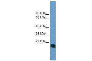 NT5M antibody used at 1 ug/ml to detect target protein. (NT5M antibody  (N-Term))