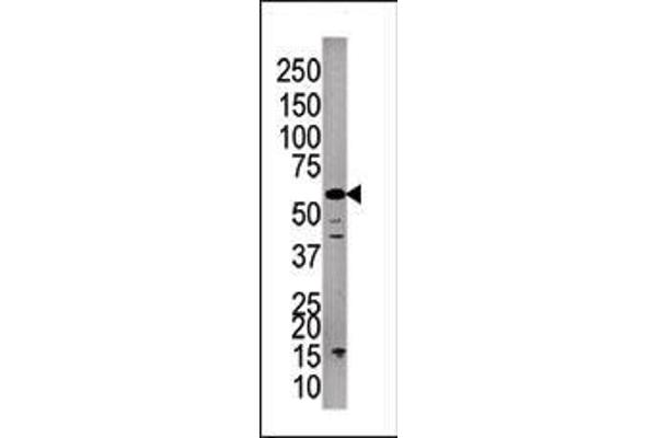 PPP3CC antibody  (C-Term)