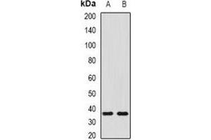 Western blot analysis of SHOX2 expression in NIH3T3 (A), mouse liver (B) whole cell lysates. (SHOX2 antibody)