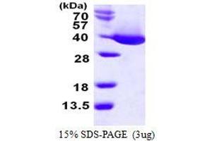 Image no. 1 for MDH protein (His tag) (ABIN1098249) (MDH protein (His tag))