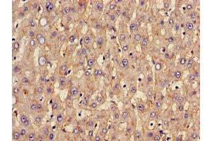 Immunohistochemistry of paraffin-embedded human liver tissue using ABIN7170002 at dilution of 1:100 (GLUT1 antibody  (AA 263-458))