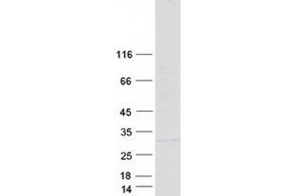 COMMD5 Protein (Transcript Variant 2) (Myc-DYKDDDDK Tag)