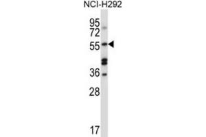 Western Blotting (WB) image for anti-Sorting Nexin 1 (SNX1) antibody (ABIN2997694) (Sorting Nexin 1 antibody)