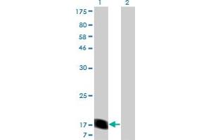 Western Blot analysis of RHEB expression in transfected 293T cell line by RHEB monoclonal antibody (M05), clone 1E12. (RHEB antibody  (AA 1-184))