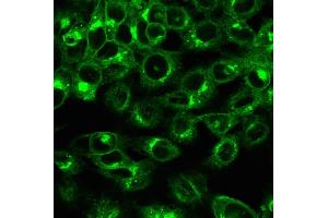 Immunofluorescence Analysis of HeLa cells labeling with Beta-2-Microglobulin Mouse Recombinant Monoclonal Antibody (rB2M/961) followed by Goat anti-mouse IgG-CF488 (Green). (Recombinant beta-2 Microglobulin antibody)