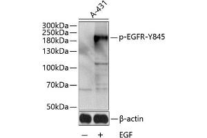 Western blot analysis of extracts of A-431 cells, using Phospho-EGFR-Y845 antibody (ABIN3019454, ABIN3019455, ABIN3019456 and ABIN6225380) at 1:1000 dilution. (EGFR antibody  (pTyr845))