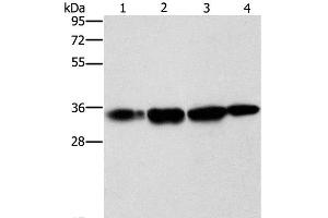 Western Blot analysis of Hela cell and Human prostate tissue, A172 cell and Mouse liver tissue using NSMCE3 Polyclonal Antibody at dilution of 1:1500 (Necdin-Like 2 antibody)