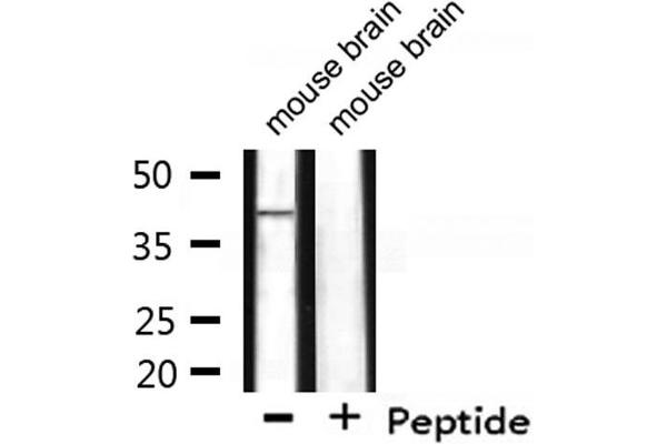 WNT7A antibody  (Internal Region)