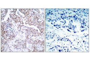 Immunohistochemistry (IHC) image for anti-Tumor Protein P53 (TP53) (pSer15) antibody (ABIN1847519) (p53 antibody  (pSer15))