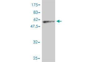 Western Blot detection against Immunogen (63. (STEAP1 antibody  (AA 1-339))