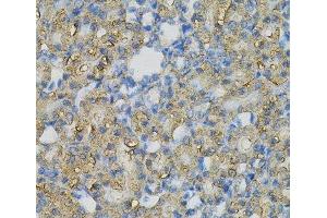 Immunohistochemistry of paraffin-embedded Rat kidney using INPP5J Polyclonal Antibody at dilution of 1:100 (40x lens). (INPP5J antibody)