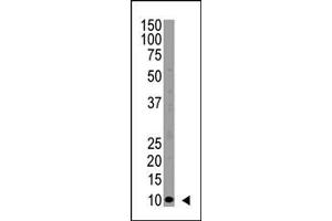 Image no. 1 for anti-Ubiquitin (Ubiquitin) (N-Term) antibody (ABIN356746) (Ubiquitin antibody  (N-Term))