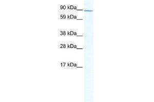 Western Blot showing ZHX2 antibody used at a concentration of 1-2 ug/ml to detect its target protein. (ZHX2 antibody  (C-Term))