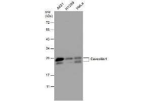 WB Image Caveolin 1 antibody detects Caveolin 1 protein by western blot analysis. (Caveolin-1 antibody  (N-Term))
