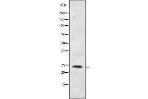 Western blot analysis ORM2 using HT29 whole cell lysates (Orosomucoid 2 antibody)