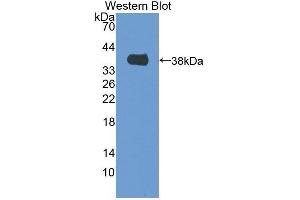 Western blot analysis of the recombinant protein. (MTFMT antibody  (AA 78-386))