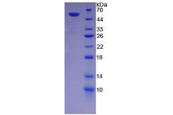 Desmoglein 1 Protein (DSG1)