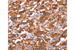 Immunohistochemistry (IHC) image for anti-Growth Arrest-Specific 8 (GAS8) antibody (ABIN2434684) (GAS8 antibody)