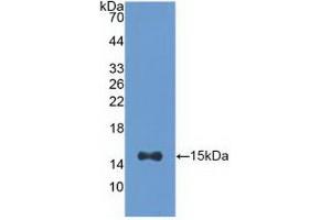 Detection of Recombinant ACO1, Human using Polyclonal Antibody to Aconitase 1 (ACO1) (Aconitase 1 antibody  (AA 458-586))