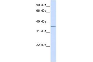 ALDOC antibody used at 1 ug/ml to detect target protein. (ALDOC antibody  (C-Term))