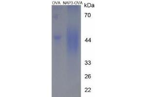 Image no. 3 for Chemokine (C-X-C Motif) Ligand 1 (Melanoma Growth Stimulating Activity, Alpha) (CXCL1) peptide (Ovalbumin) (ABIN5666309) (Chemokine (C-X-C Motif) Ligand 1 (Melanoma Growth Stimulating Activity, Alpha) (CXCL1) peptide (Ovalbumin))