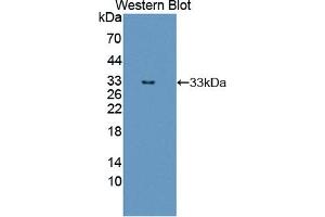 Detection of Recombinant ErbB3, Human using Polyclonal Antibody to V-Erb B2 Erythroblastic Leukemia Viral Oncogene Homolog 3 (ErbB3) (ERBB3 antibody  (AA 709-966))