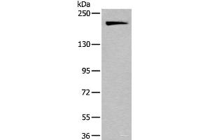 Western blot analysis of HUVEC cell lysate using IQGAP1 Polyclonal Antibody at dilution of 1:300 (IQGAP1 antibody)