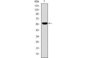 Western Blotting (WB) image for anti-Fibrinogen gamma Chain (FGG) antibody (ABIN969142)