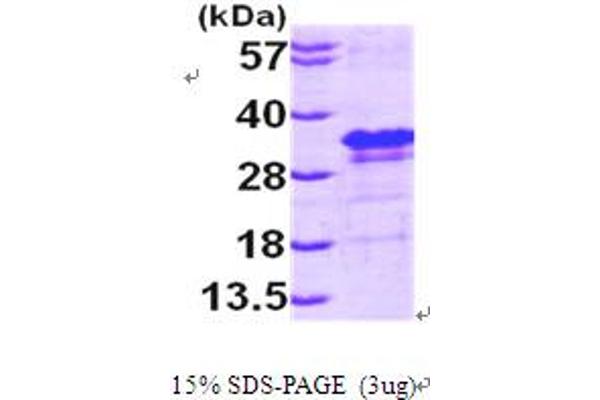 EIF4E Protein (AA 1-217) (His tag)