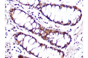 Immunohistochemistry of paraffin-embedded human colon using Cullin 4A Rabbit mAb (ABIN7266545) at dilution of 1:100 (40x lens). (Cullin 4A antibody)