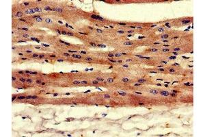 Immunohistochemistry of paraffin-embedded human heart tissue using ABIN7149764 at dilution of 1:100 (Desmin antibody  (AA 2-86))