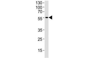 Western blot analysis of human brain tissue lysate using DCX antibody at 1:1000. (Doublecortin antibody  (AA 107-137))