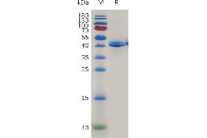 Mouse TACI Protein, hFc Tag on SDS-PAGE under reducing condition. (TACI Protein (AA 1-125) (Fc Tag))