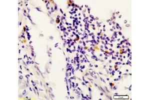 Formalin-fixed and paraffin embedded rat uterus labeled with Anti-STAT6 Polyclonal Antibody, Unconjugated  at 1:200 followed by conjugation to the secondary antibody and DAB staining. (STAT6 antibody  (AA 601-700))