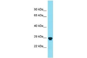 Host: Rabbit Target Name: RNF151 Sample Type: THP-1 Whole Cell lysates Antibody Dilution: 1. (RNF151 antibody  (Middle Region))