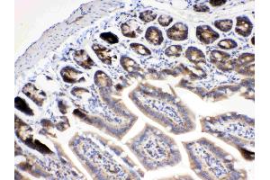 IHC analysis of RanBP1 using anti- RanBP1 antibody . (RANBP1 antibody  (AA 2-201))