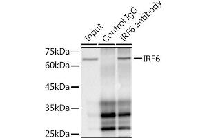 Immunoprecipitation analysis of 300 μg extracts of HepG2 cells using 3 μg IRF6 antibody (ABIN1680921, ABIN3017588, ABIN3017589 and ABIN7101507). (IRF6 antibody)