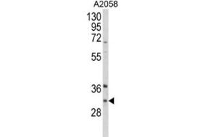 Western Blotting (WB) image for anti-Inhibitor of Growth Family, Member 5 (ING5) antibody (ABIN3004197) (ING5 antibody)