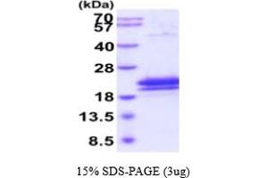 SDS-PAGE (SDS) image for Interleukin 17B (IL17B) (AA 21-180) protein (His tag) (ABIN6387979) (IL17B Protein (AA 21-180) (His tag))