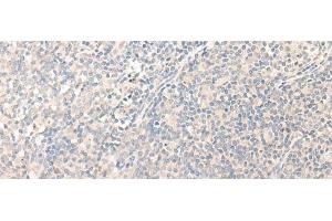 Immunohistochemistry of paraffin-embedded Human tonsil tissue using RADIL Polyclonal Antibody at dilution of 1:40(x200) (Radil antibody)