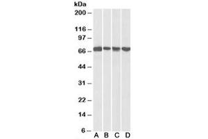 Western blot testing of mouse NIH3T3 [A], HeLa [B], A431 [C] and Jurkat [D] nuclear lysates with DDX5 antibody at 0. (DDX5 antibody)