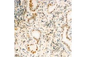 Immunohistochemical analysis of FUBP3 staining in human kidney formalin fixed paraffin embedded tissue section. (FUBP3 antibody)