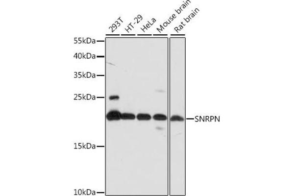 SNRPN antibody  (AA 1-100)