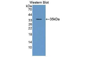 Western blot analysis of the recombinant protein. (Geminin antibody  (AA 8-206))